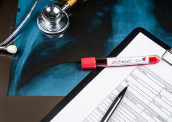 Preporuke građanima vezane za Korona virus