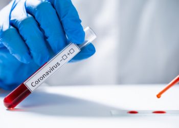 Dva nova slučaja zaraze koronavirusom u Mostaru