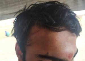 Policija lomi ruke i noge migrantima u Vojvodini