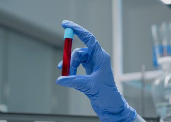 Je li kosovska krv dovoljno dobra za Srbiju?